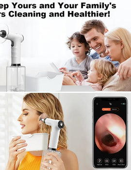 500ML Electric Visual Ear Canal Washer Tool 4 Speed Pressure Mode Earwax Removal Irrigation Kits Ear Cleaner
