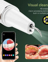 Ultrasonic Dental Calculus Remover Electric Dental Tooth Stone Remover LED Teeth Plaque Scaler Tartar Eliminator Stains Cleaner