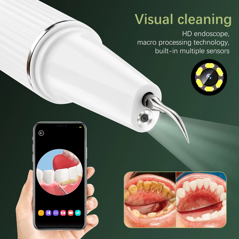 Ultrasonic Dental Calculus Remover Electric Dental Tooth Stone Remover LED Teeth Plaque Scaler Tartar Eliminator Stains Cleaner