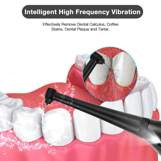Home Calculus Remover Dental Scaling Electric Scaler Sonic Smoke Stains Tartar Plaque Teeth Whitening Dental Scaler