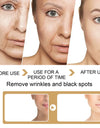 30ml Turmeric Oil Skin To Lightening Acne Dark Patches Acne Bright Skin Dark Spot Corrector Anti Aging Face Whitening Serum Care