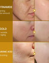 15 ml Niacinamide Serum Hyaluronic Acid for Face Dark Spot Remover 24K Gold Serum Whitening Moisturizing Facial Skin Care