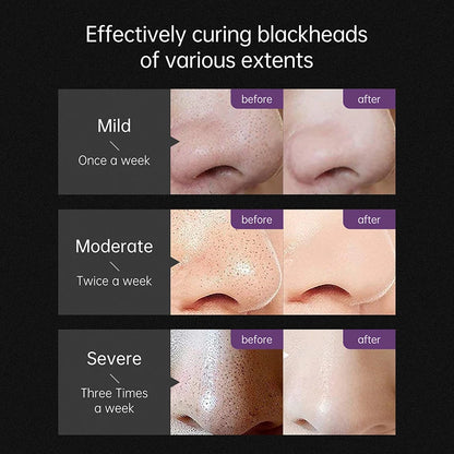 Blackhead Remover Black Dots Facial Masks Nose Bamboo Charcoal Point Pimple Anti Acne Spot Face Skin Care Beauty Health