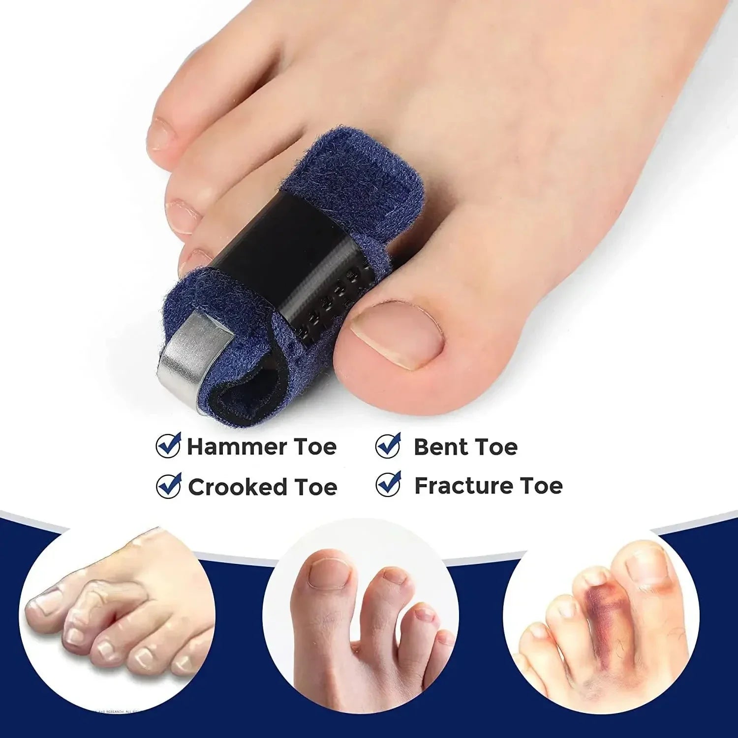 1/2Pcs Splint Toe Straightener Hammer Corrector Toe Brace Hammertoe Splint Toe Wrap Covers Broken Bunion Foot Care Tools