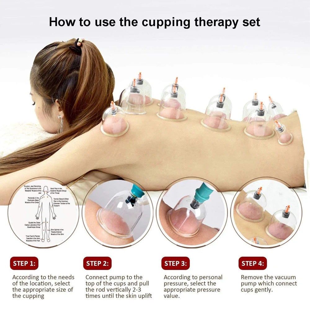 12/24 Cans Cups Chinese Vacuum Cupping Kit Pull Out Vacuum Apparatus Therapy Relax Massager Curve Suction Pumps