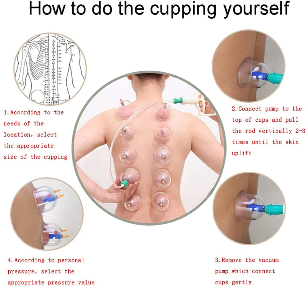 12/24 Cans Cups Chinese Vacuum Cupping Kit Pull Out Vacuum Apparatus Therapy Relax Massager Curve Suction Pumps