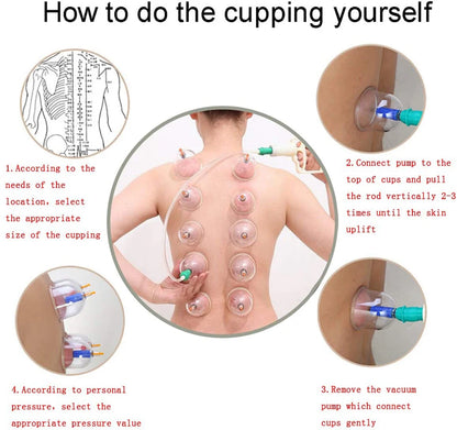 12/24 Cans Cups Chinese Vacuum Cupping Kit Pull Out Vacuum Apparatus Therapy Relax Massager Curve Suction Pumps