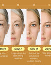 15 ml Niacinamide Serum Hyaluronic Acid for Face Dark Spot Remover 24K Gold Serum Whitening Moisturizing Facial Skin Care