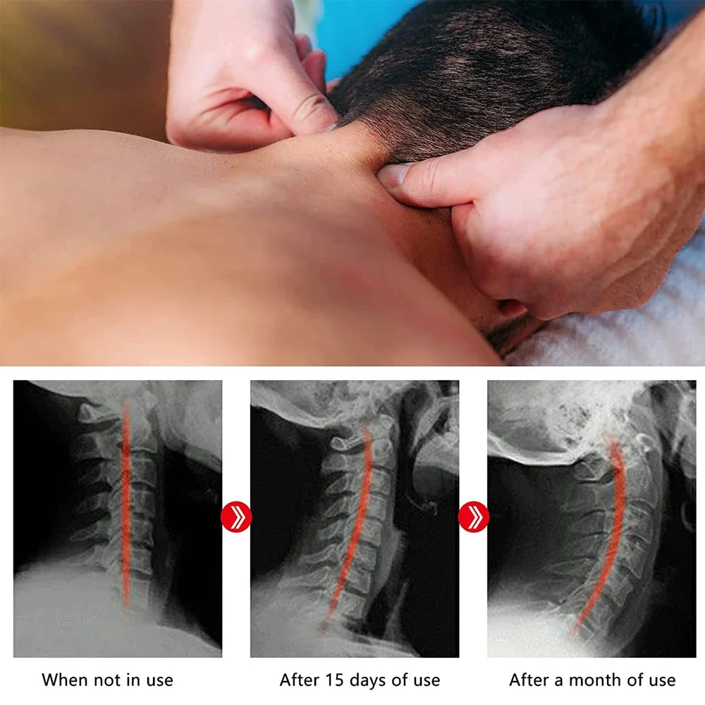 Cervical Traction Device Pillow Neck Stretcher Equipment for TMJ Neck Pain Relief Neck and Shoulder Relaxer