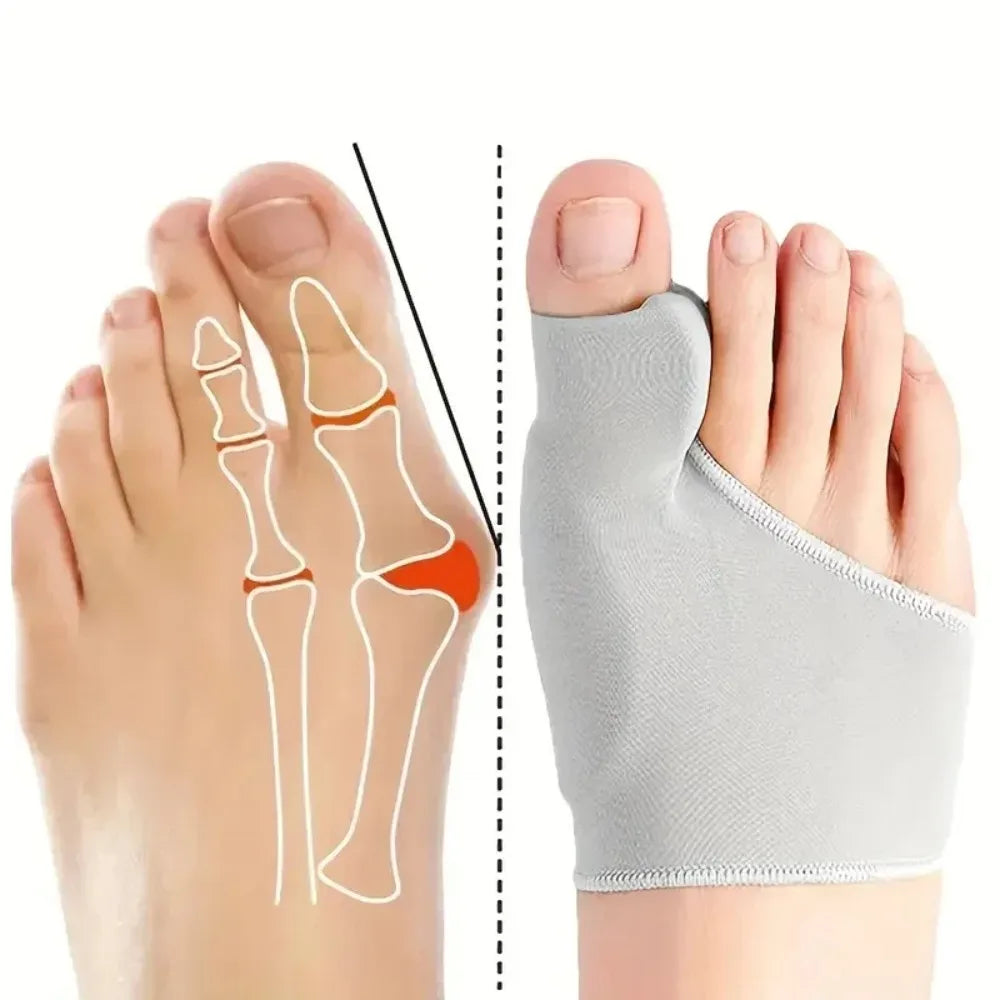 1Pair Toe Separator Hallux Valgus Bunion Corrector Hammer Toe Straightener Foot Pain Relief Orthopedic Pedicure Tools Foot Care