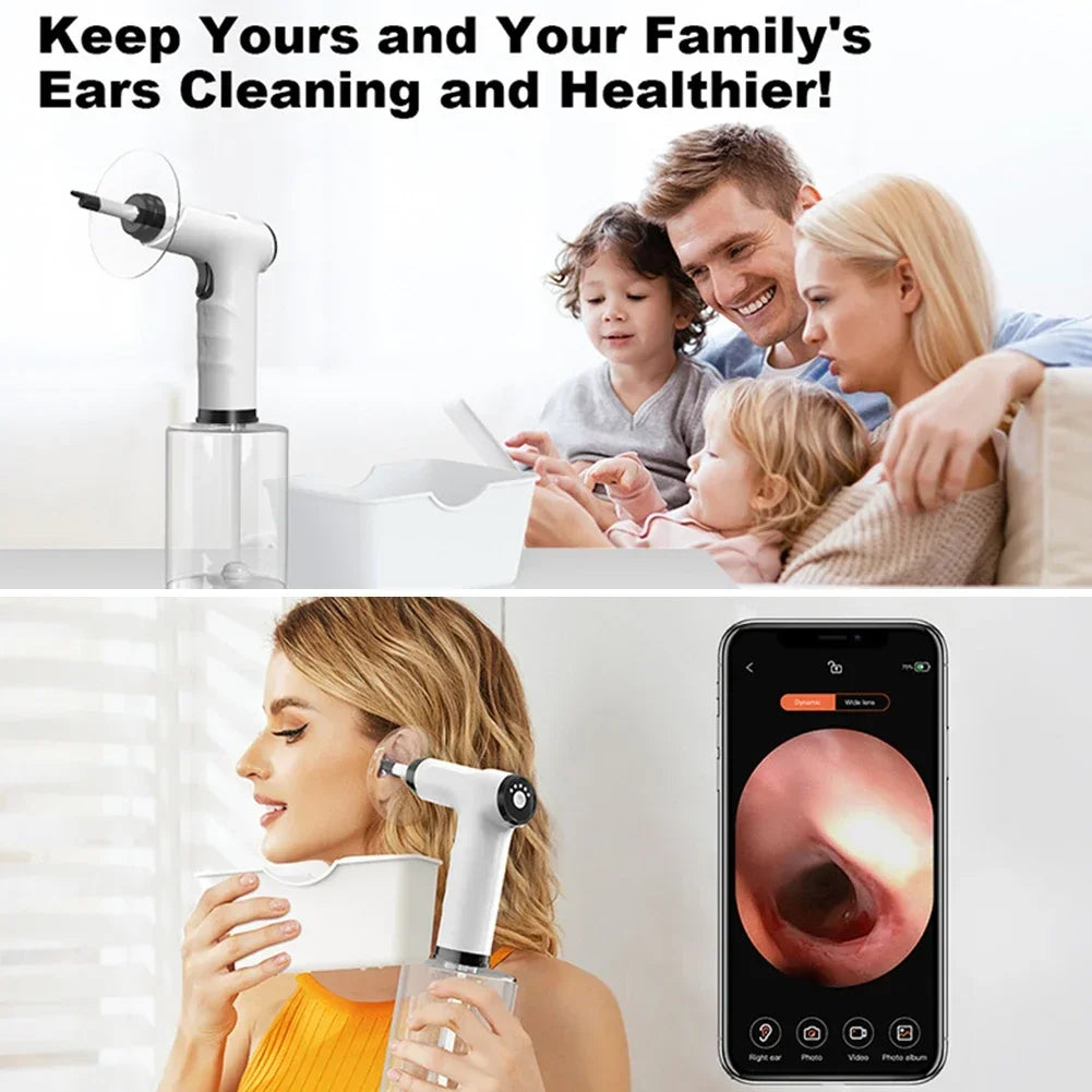 500ML Electric Visual Ear Canal Washer Tool 4 Speed Pressure Mode Earwax Removal Irrigation Kits Ear Cleaner