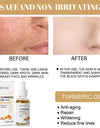 30ml Turmeric Oil Skin To Lightening Acne Dark Patches Acne Bright Skin Dark Spot Corrector Anti Aging Face Whitening Serum Care