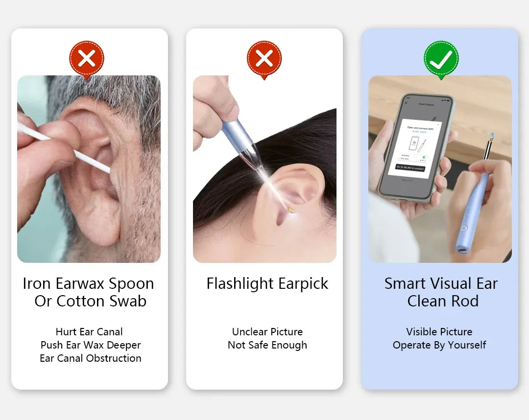 Xlife X3 Visual Earwax Remover With Camera,Smart Ear Cleaner 3.0 Mega Pixels Endoscope Otoscope For Earpick Health Care