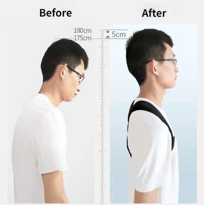 Adjustable Back Shoulder Posture Corrector Belt Clavicle Spine Support Brace Reshape Body Health Fixer Tape corrector de postura