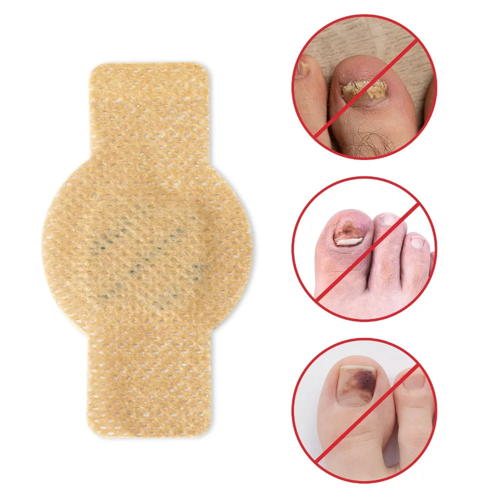 21Pcs Toenail Fungus Patch Waterproof Nail Repair Patches Nail Ingrown Correction Sticker Discolored Damaged Nail Foot Care Tool
