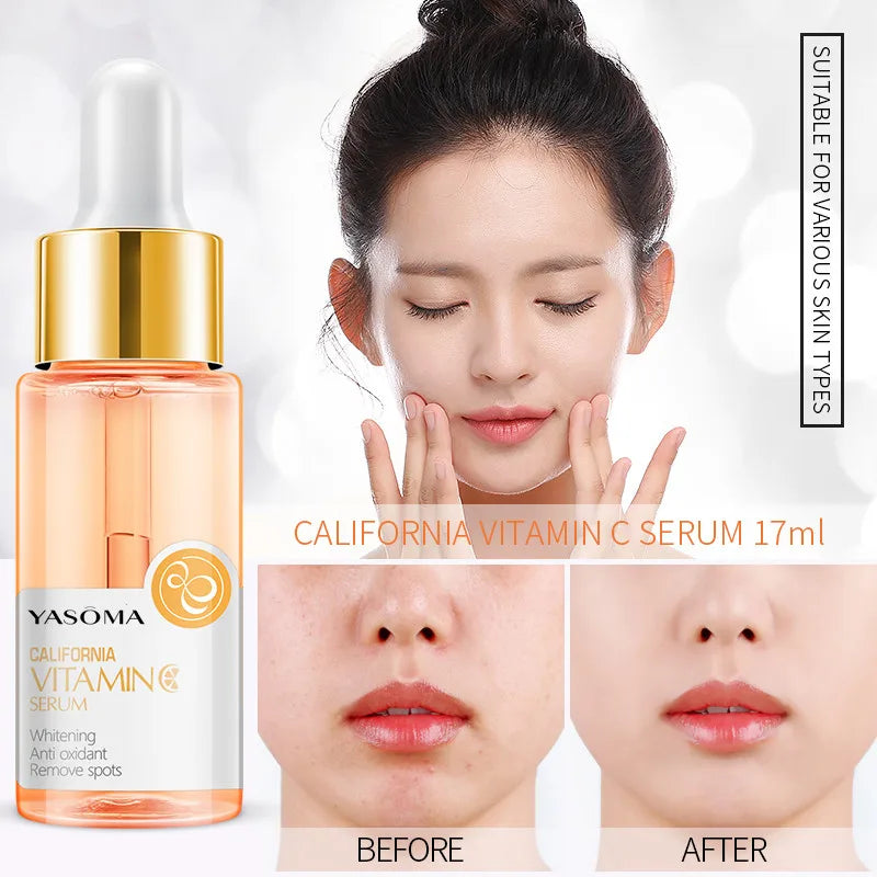 17 ml Vitamin C Face Serum Brightening Whitening Hydration Anti-Wrinkle Anti-aging Serum Facial Essence Beauty Health Skin Care