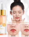 17 ml Vitamin C Face Serum Brightening Whitening Hydration Anti-Wrinkle Anti-aging Serum Facial Essence Beauty Health Skin Care