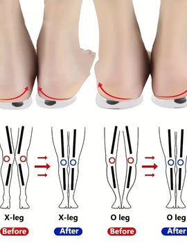 1Pair Orthopedic Insoles for Feet O/X Leg Type Valgus Correction Men Women Silicone Gel Shoes Insole Magnet Massage Shoe Pads