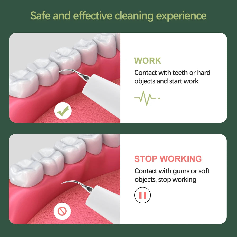 Ultrasonic Dental Calculus Remover Electric Dental Tooth Stone Remover LED Teeth Plaque Scaler Tartar Eliminator Stains Cleaner