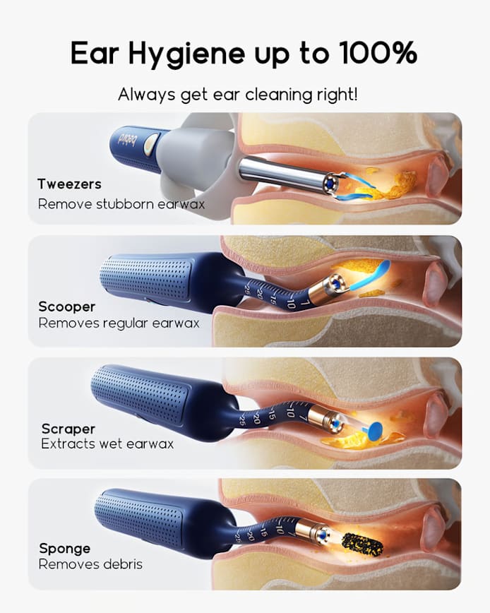 White Ear Sight Plus R37R I35R|Smart Visual Ear Cleaner/Bendable Rod|All-in-1 Safe Earwax Removal Kit