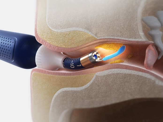 EarSight Plus I35R R37R D39R Visual Earpick Bendable & Affordable All-in-1 Ear Rod Earwax Removal Kits